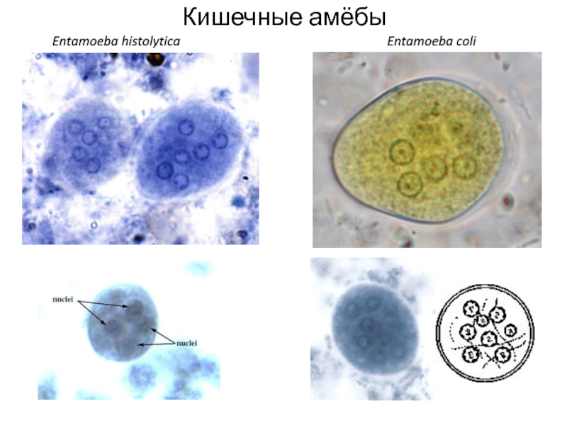 Кишечная амеба рисунок