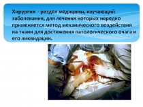 Хирургия - раздел медицины, изучающий заболевания, для лечения которых нередко