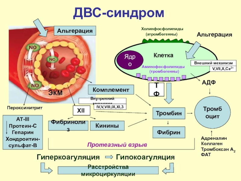 Патогенез синдрома. Синдром диссеминированного внутрисосудистого свертывания этиология. ДВС синдром механизм развития. ДВС синдром патогенез по стадиям. Механизмы развития гиперкоагуляции при ДВС-синдроме..