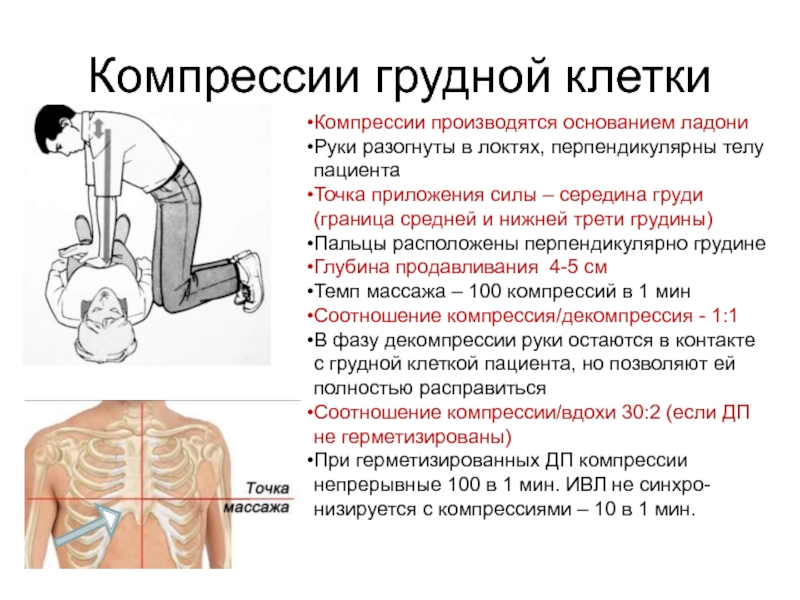 Частота надавливания при проведении компрессии. Соотношение компрессии грудной клетки. СЛР место компрессии грудной клетки. Глубина компрессий грудной клетки при СЛР. Место компрессии грудной клетки при СЛР взрослому.