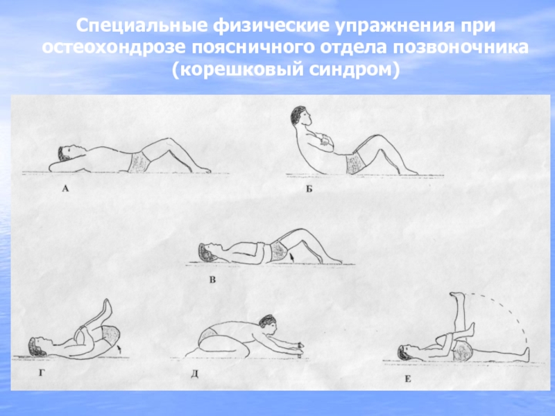 Карта вызова скорой помощи остеохондроз поясничного отдела позвоночника корешковый синдром