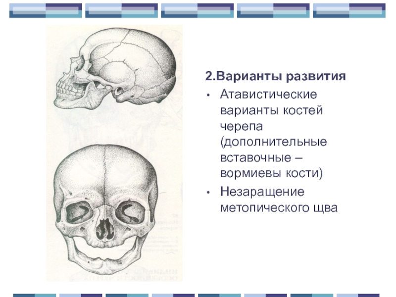 Кости черепа презентация анатомия