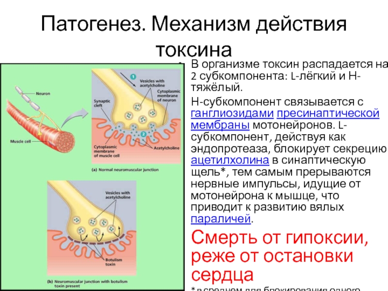 Ботулизм патогенез схема