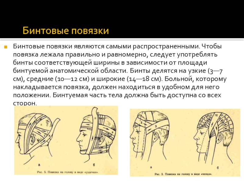 Бинтовые повязки на голову. Бинтовые повязки. Виды бинтовых повязок. Самые распространённые бинтовые повязки. Бинтовая повязка на рога.