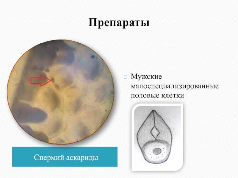 Спермий аскариды рисунок