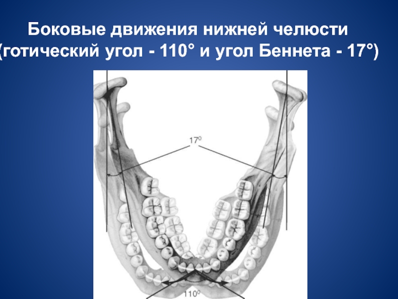 Угол движения. Угол трансверзального суставного пути угол Беннета. Угол Беннета в стоматологии. Трансверзальные (боковые) движения нижней челюсти. Угол трансверзального резцового пути Готический.