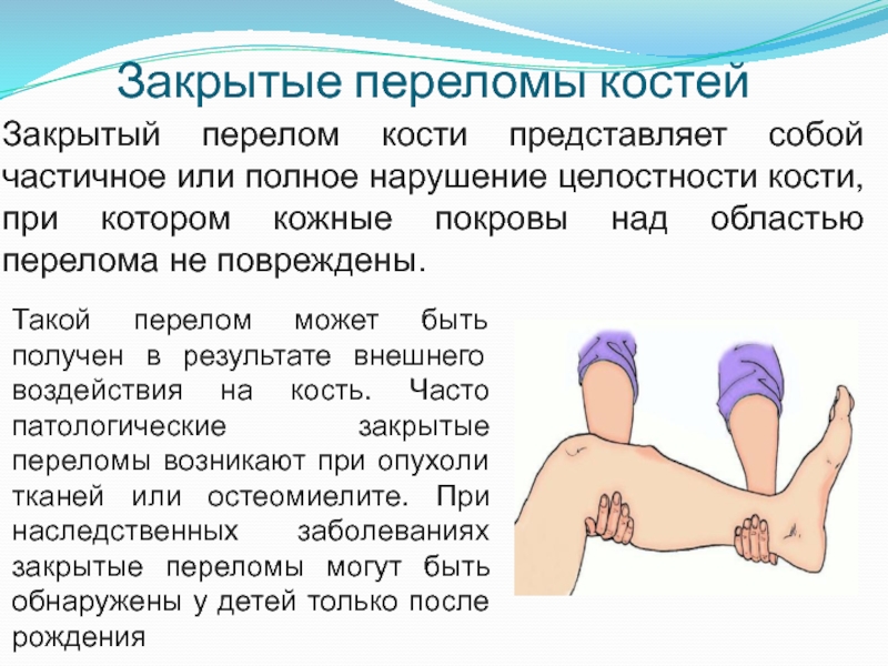 Перелом костей у детей