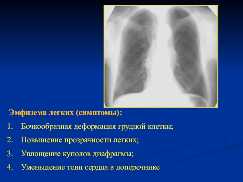 Обеднение легочного рисунка на рентгенограмме