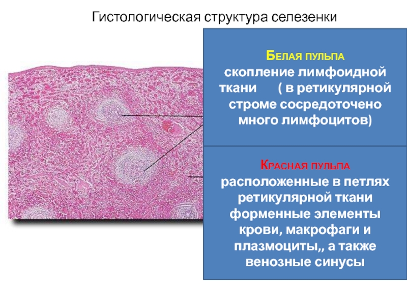 Селезенка рисунок гистология