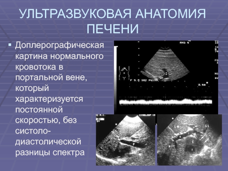 Доплерографическое исследование головного мозга