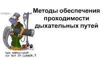 Методы обеспечения проходимости дыхательных путей