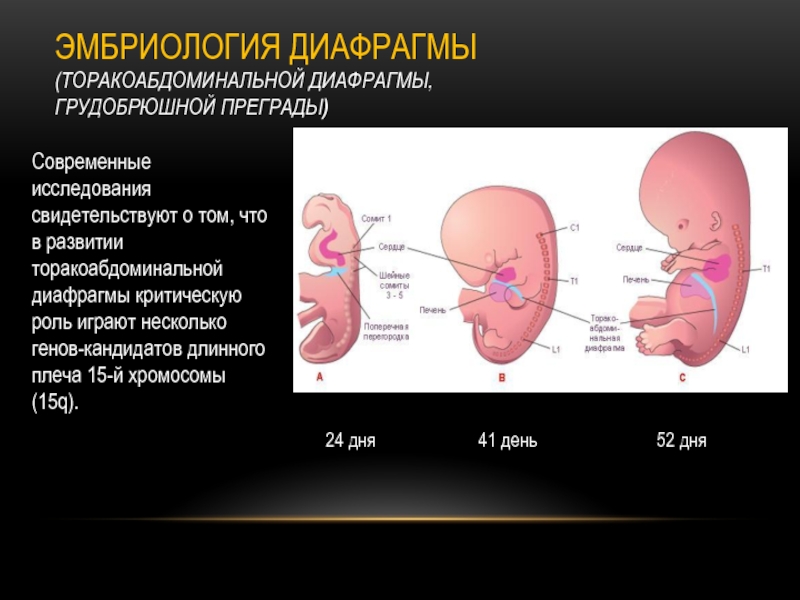 Презентация на тему диафрагмальные грыжи