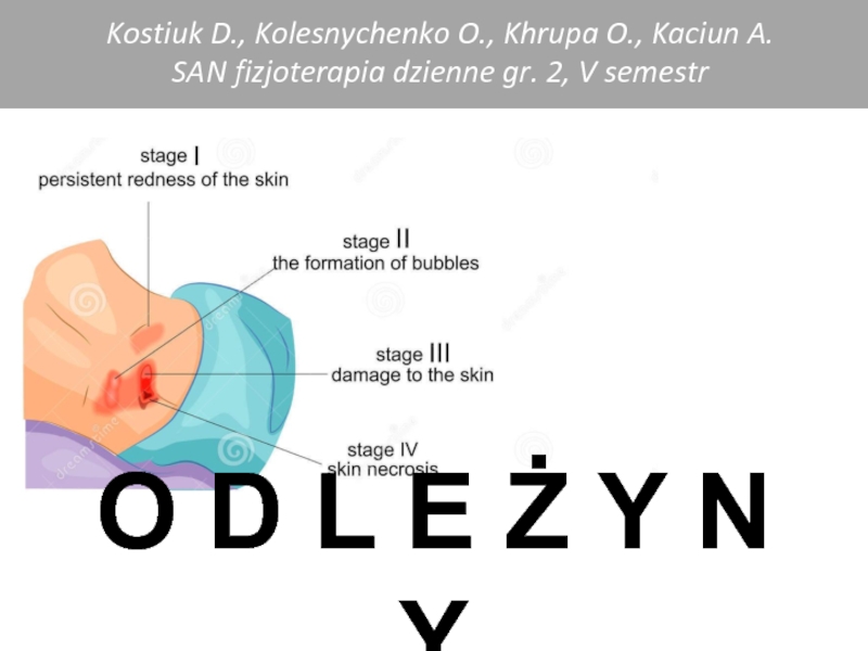 Презентация O D L E Ż Y N Y