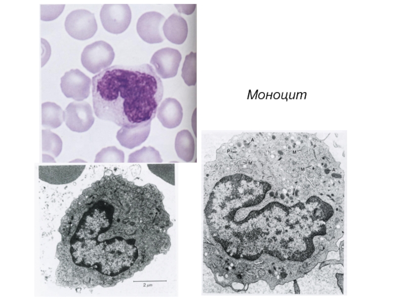 Ткани внутренней среды. Моноцит гистология препарат. Моноцит электронная микрофотография. Моноцит под микроскопом гистология. Моноциты строение.