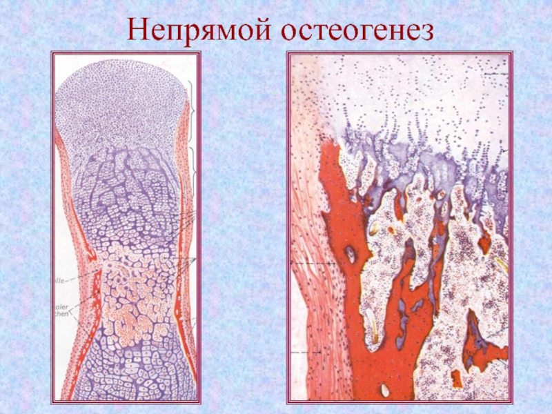 Непрямой остеогенез схема