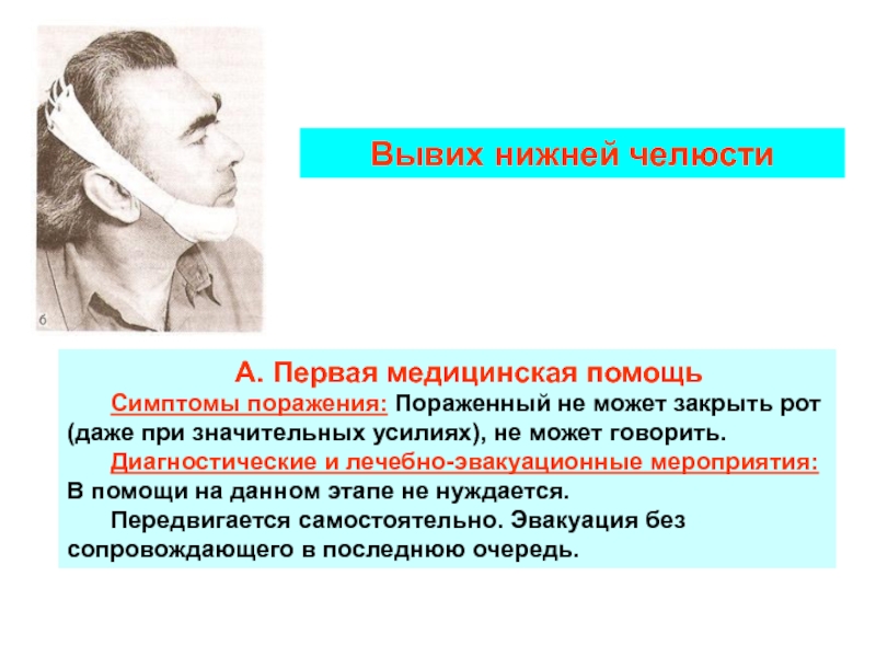 Вывих нижней челюсти. При двухстороннем вывихе нижней челюсти отмечается. Повязка при вывихе нижней челюсти. Вывихи нижней челюсти классификация.