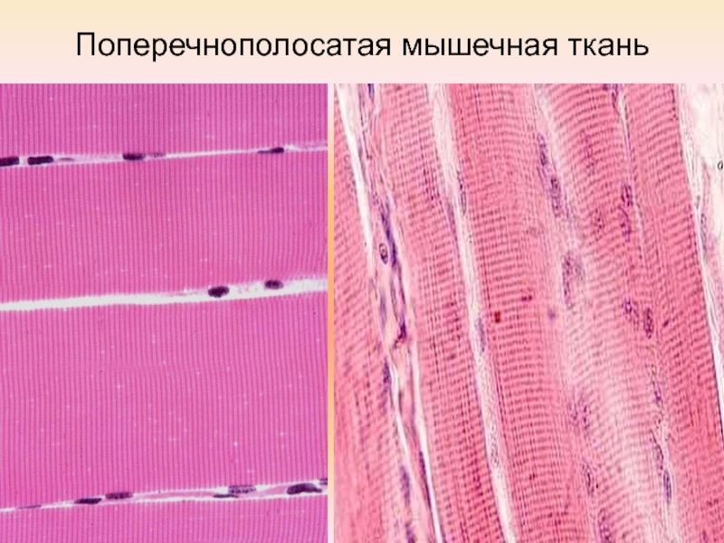 Скелетная поперечно полосатая мускулатура состоит из. Поперечнополосатая мышечная ткань. Поперечно-полосатая Скелетная мышечная ткань. Поперечнополосатая Скелетная мышечная ткань. Исчерченная Скелетная мышечная ткань.
