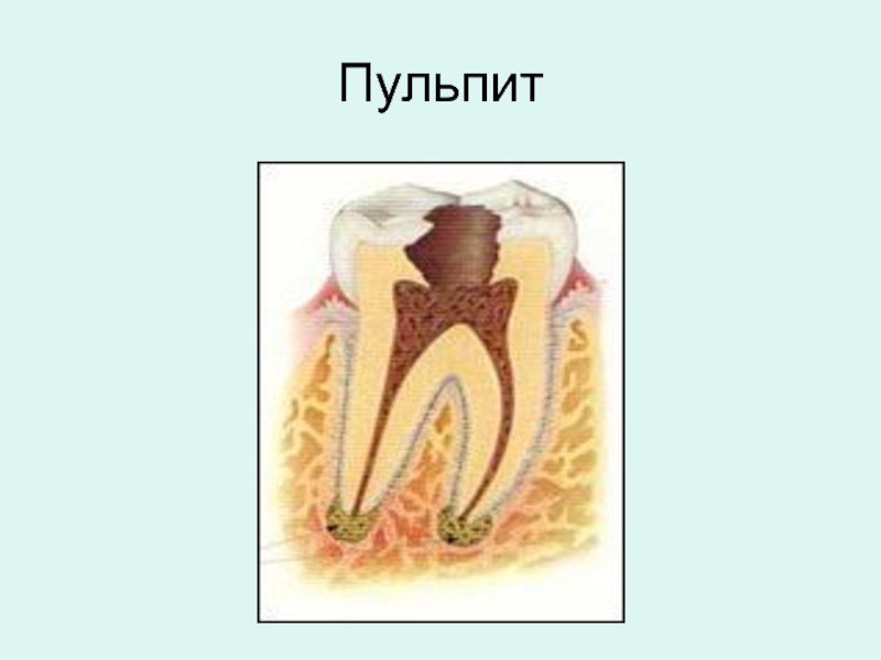 Пульпа зуба презентация