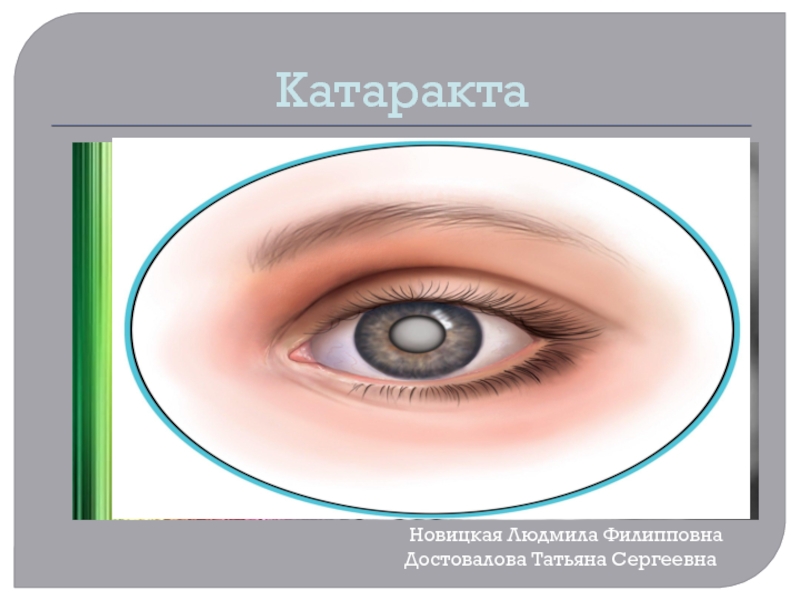 Презентация Катаракта