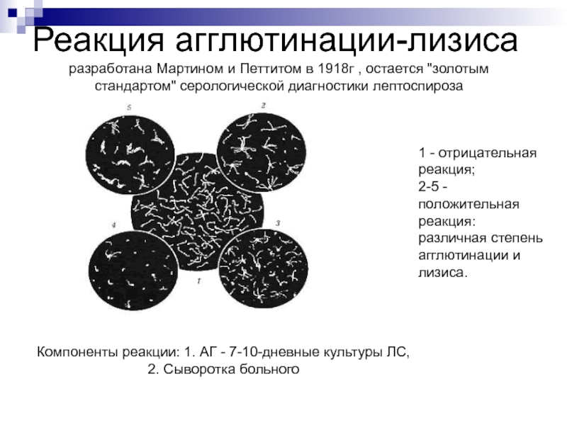 Реакция агглютинации микробиология схема