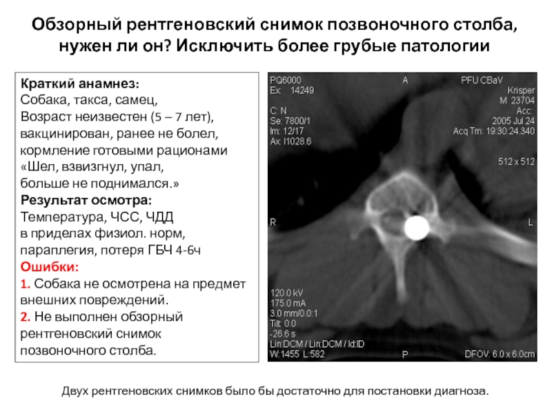 Обзорный рентгеновский снимок позвоночного столба,  нужен ли он? Исключить более грубые патологииКраткий анамнез:Собака, такса, самец,Возраст неизвестен
