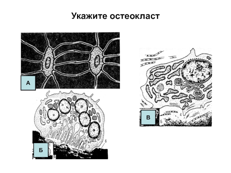 Схема строение остеокласта