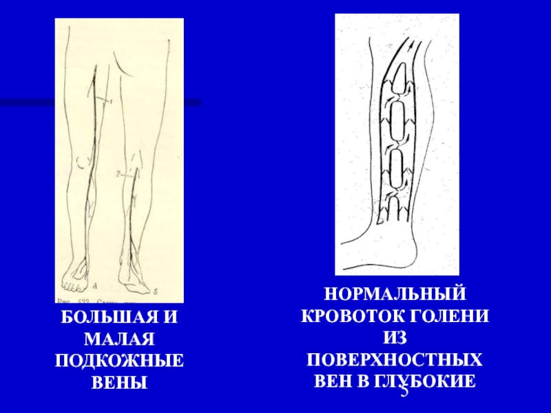 Варикоз корнилова схема