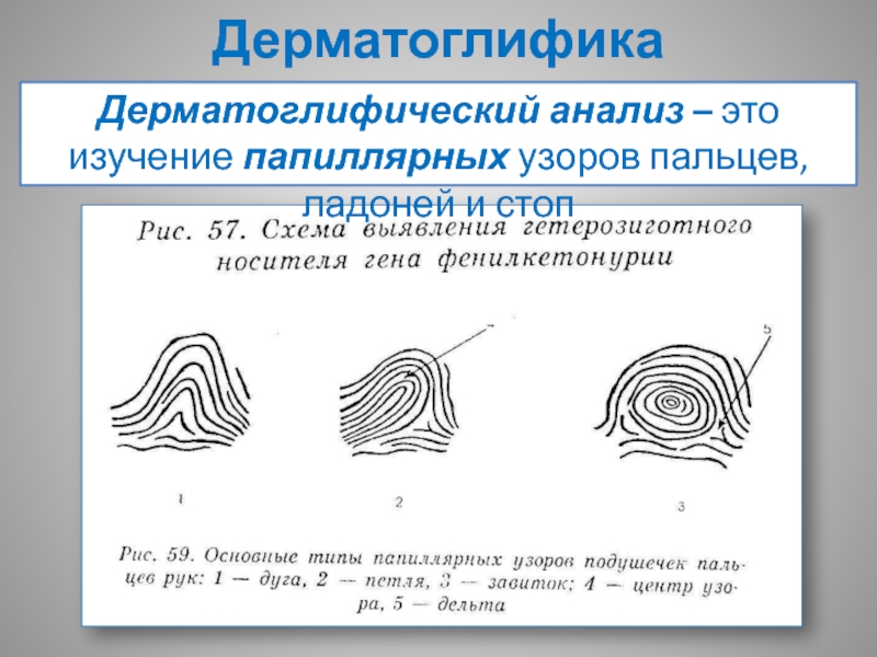 Установите соответствие рисунков ниже и изображенных на них типов папиллярных узоров