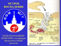 ОСТРОЕ ВОСПАЛЕНИЕ
КОШЕЛЕВ ВЛАДИМИР БОРИСОВИЧ, зав.кафедрой физиологии и общей