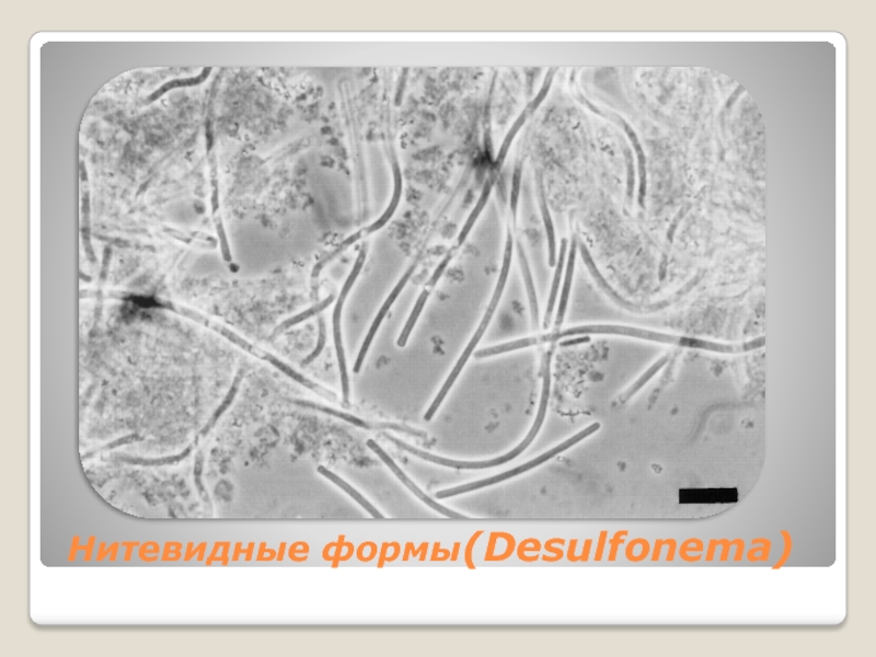 Нитевидные формы(Desulfonema)