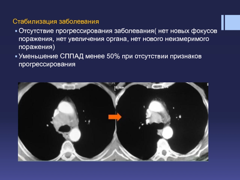 Отсутствие поражения