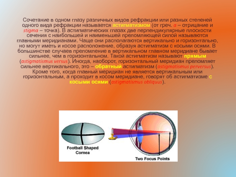 Сложный гиперметропический астигматизм глаз. Астигматизм миопический ось. Рефракция глаза астигматизм. Что такое астигматизм зрения. Зрение -5 астигматизм.