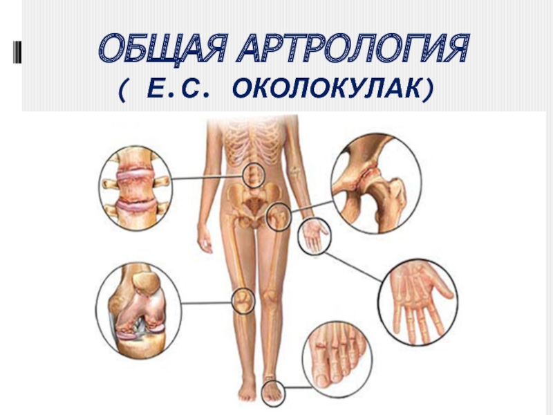 ОБЩАЯ АРТРОЛОГИЯ ( Е.С. ОКОЛОКУЛАК)