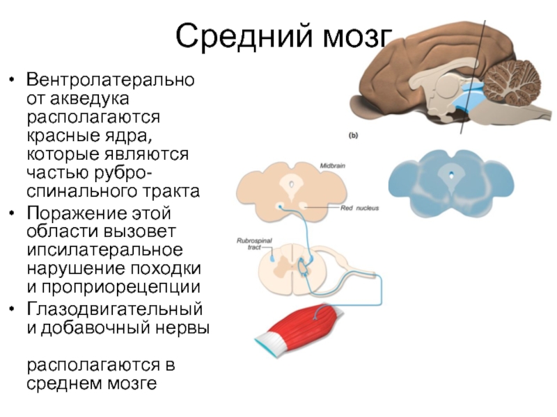 Первая неврология