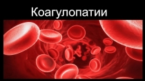 Коагулопатии р