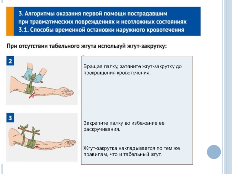 Наложение кровоостанавливающего жгута закрутки