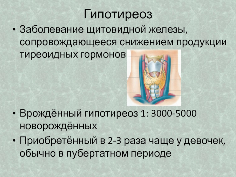 Врожденный гипотиреоз лечение. Врожденные заболевания щитовидной железы. Гипотиреоз – заболевание, сопровождающееся сниженной продукции:. Семиотика поражения щитовидной железы у детей.