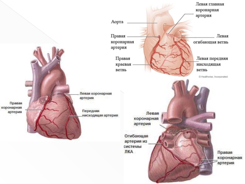 Правая сердечная артерия. Левая передняя нисходящая коронарная артерия. Ветви огибающей коронарной артерии. Коронарная артерия левой передней нисходящей ветви. Передняя межжелудочковая ветвь левой коронарной артерии.