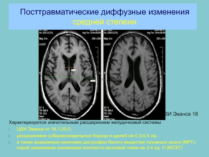 Модель эванса презентация