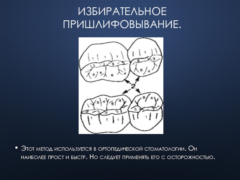 Метод окклюзии. Методика избирательного пришлифовывания. Избирательное пришлифовывание зубов. Избирательное пришлифовывание зубов методика. Метод избирательного пришлифовывания. Методика Дженкельсона..