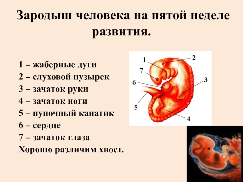 Эмбрион строение. Строение эмбриона. Структуры эмбриона человека.