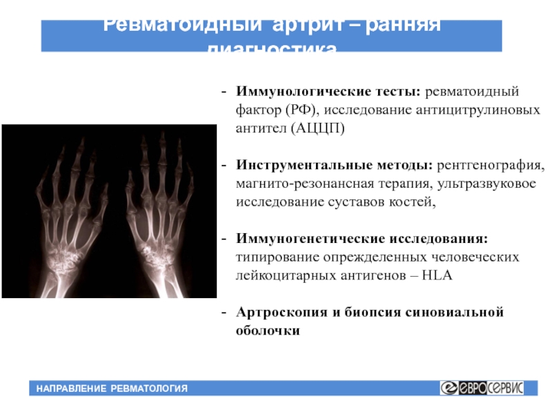 Ревматоидный артрит презентация терапия