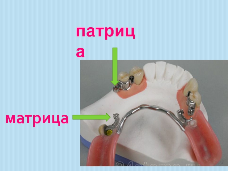 Система фиксации речи