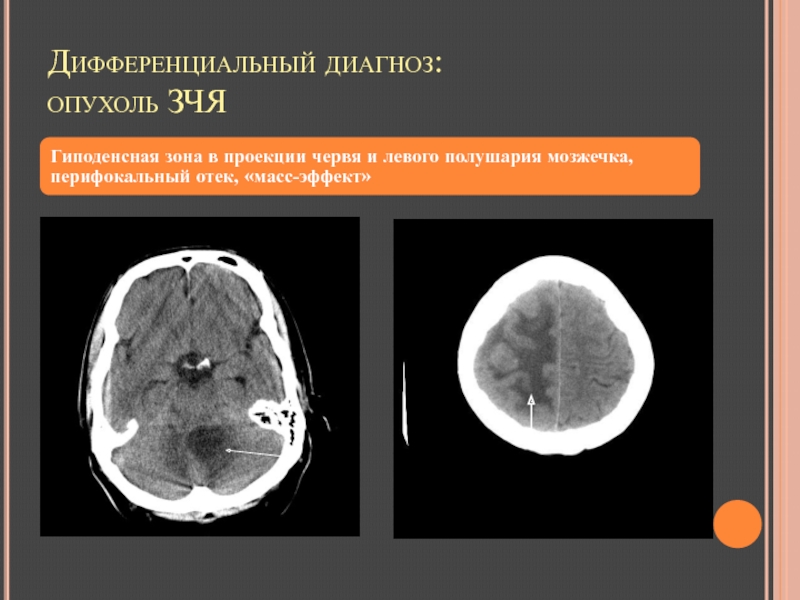 Диагноз опухоли головного