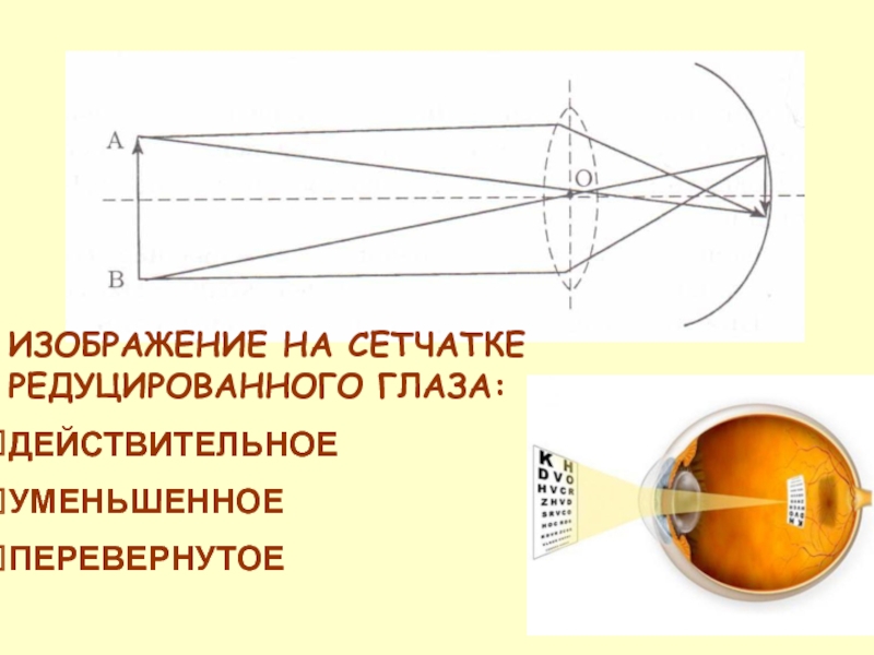 На сетчатке возникает изображение уменьшенное обратное уменьшенное прямое