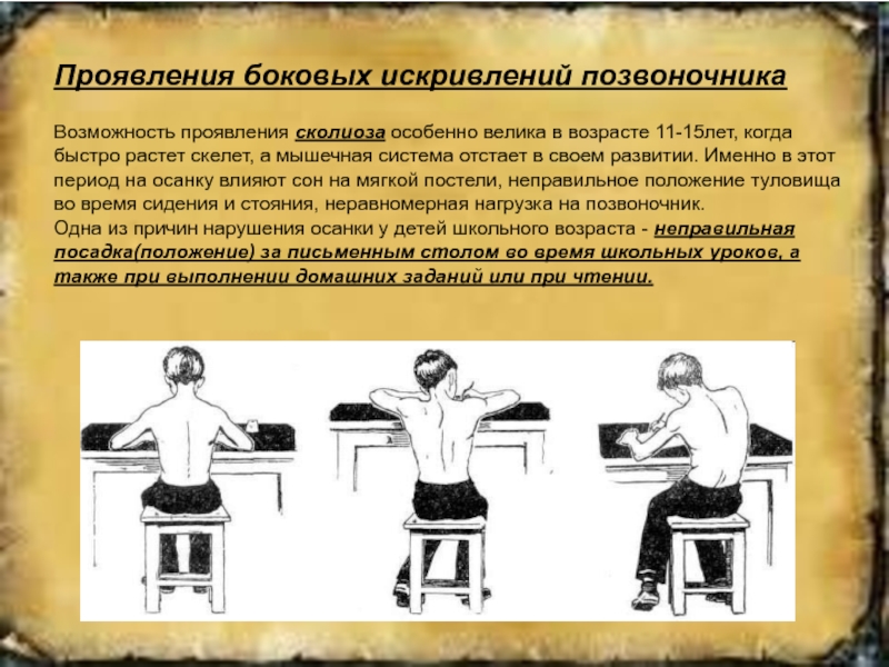 Возможность проявления. Проявление боковых искривлений позвоночника. Сколиоз спереди вид спереди. Меры профилактики сколиоза. Меры по предупреждению искривления позвоночника 8 класс.