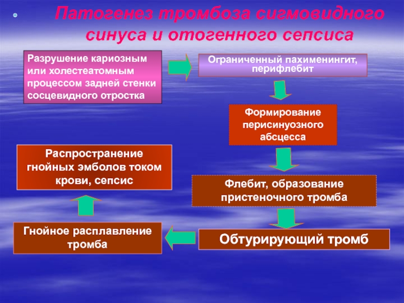 Синус тромбоз презентация