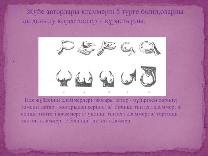 Система нея. Кламмер Аккера. Типы кламмеров. Классификация нея кламмеров. Класификация аоаммеров неу.