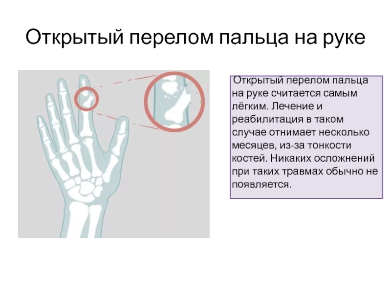 Перелом костей стопы карта вызова скорой медицинской помощи