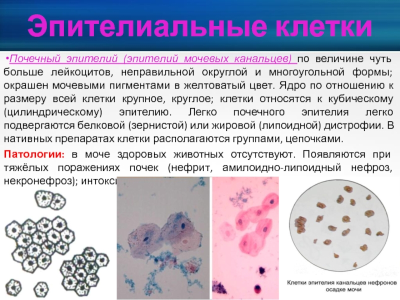 Эритроциты клетки цилиндрического эпителия